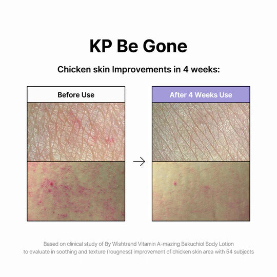 Kbeauty Glass Skin By Wishtrend Vitamin A-mazing Series 