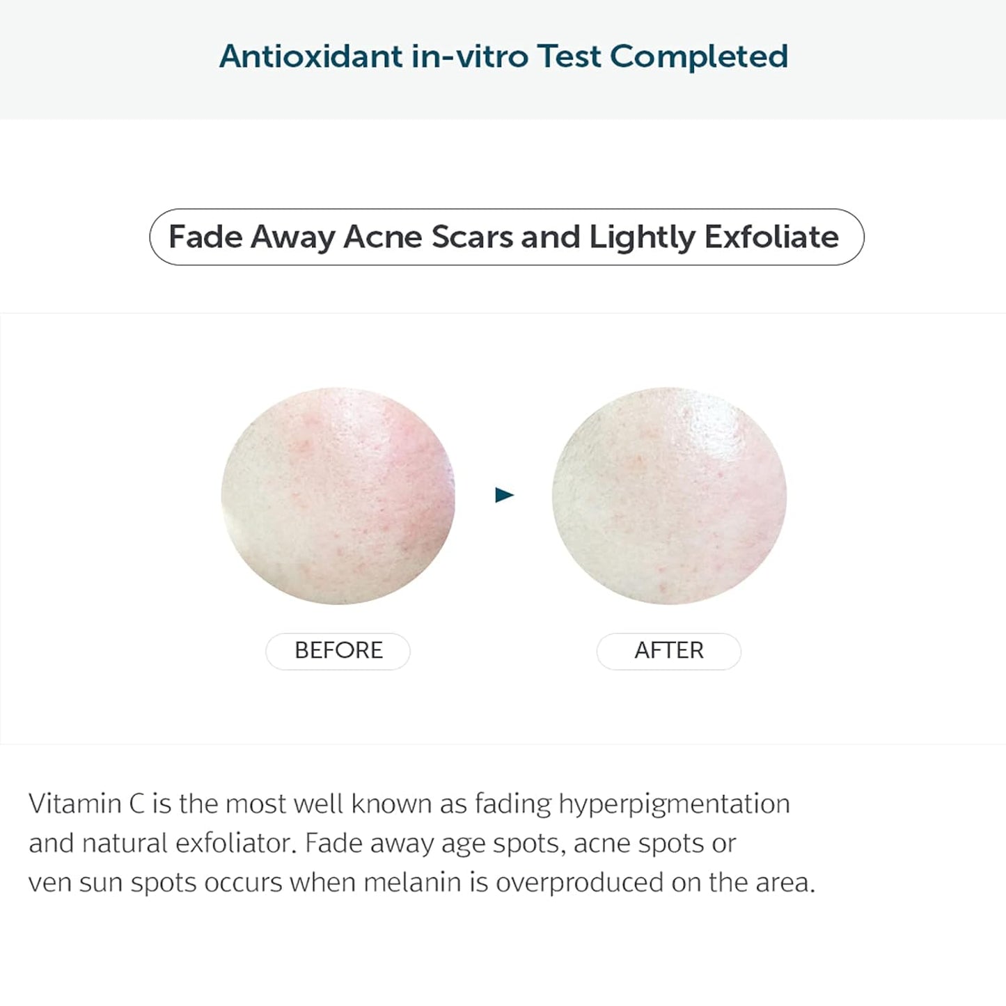 Kbeauty Glass Skin Dear, Klairs Freshly Juiced Vitamin Care 