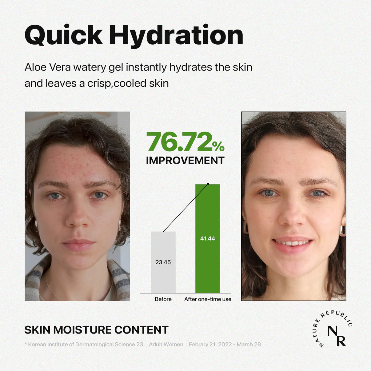Kbeauty Glass Skin Nature Republic Mild & Moisture Aloe Vera Watery Gel 